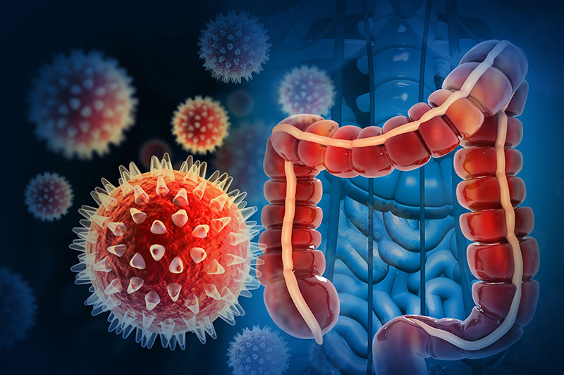 Can Surgery Cure Colon Cancer? What Patients Should Know