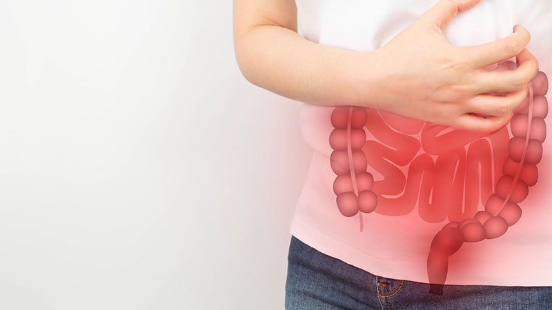 Colon Cancer Recurrence: Signs and Symptoms