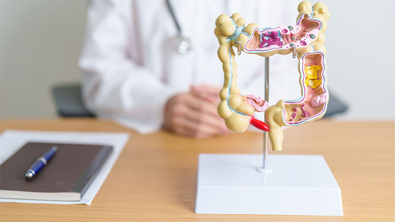 Partial vs Total Colectomy: What’s the Difference and What to Expect